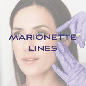 Filler: Marionette Lines