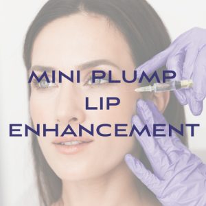Filler: Mini Plump Lip Enhancement