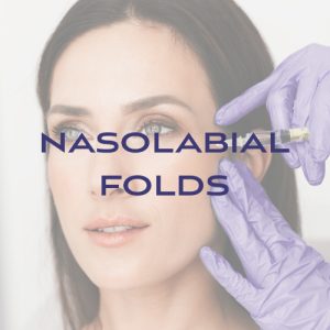 Filler: Nasolabial Folds