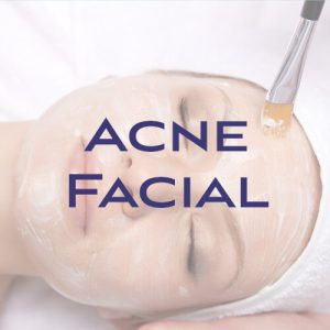 Acne Facial