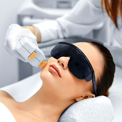 IPL Photofacials