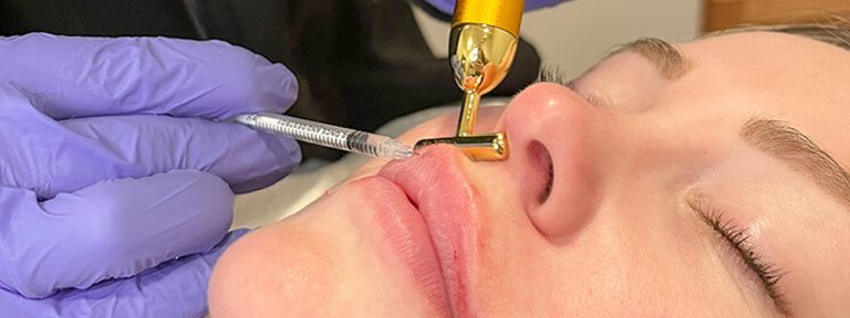 How to Prepare for Dermal Filler Injections