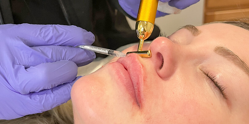 Dermal Fillers Northern Kentucky