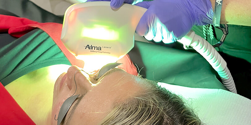 IPL Photofacial Northern Kentucky