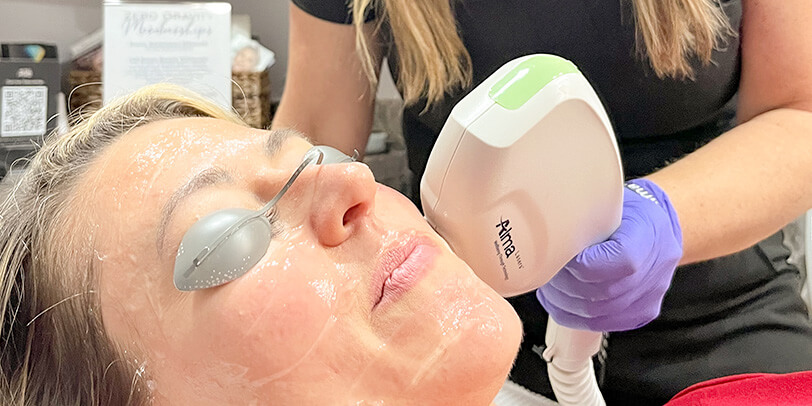 Laser Treatments Northern Kentucky