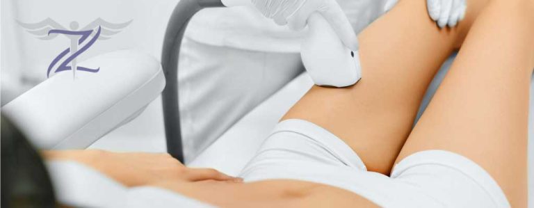 The Undeniable Benefits of Laser Hair Removal